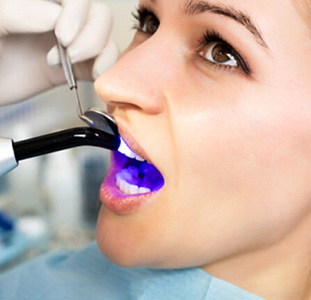a woman receiving a cosmetic dental bonding treatment