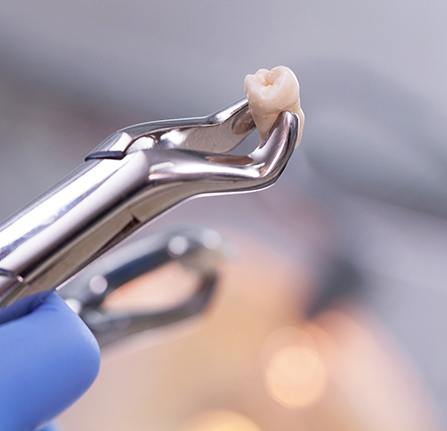 dentist holding forceps and a tooth during a tooth extraction procedure