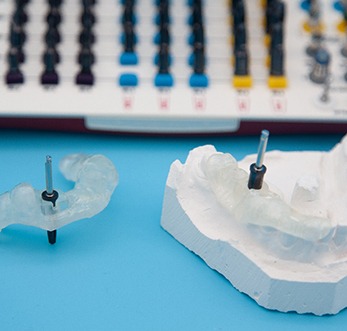 Dental implant surgical guide in Mt. Pleasant, WI