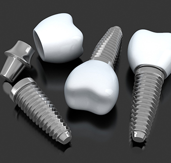 three dental implants lying on a flat surface