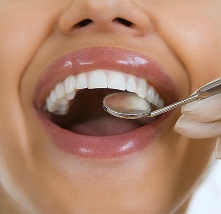 Closeup of patient receiving dental exam after tooth colored filling resotrative dentistry