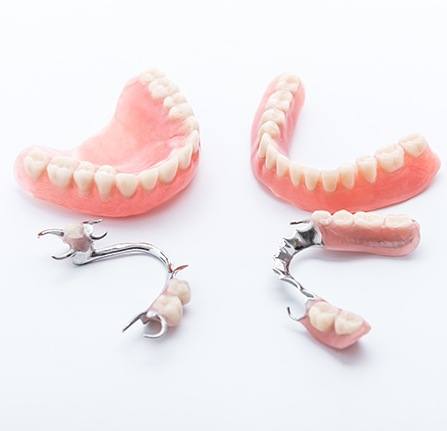 Four types of dentures