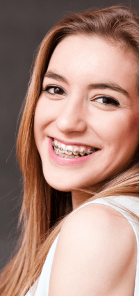 Young woman with braces during orthodontic treatment