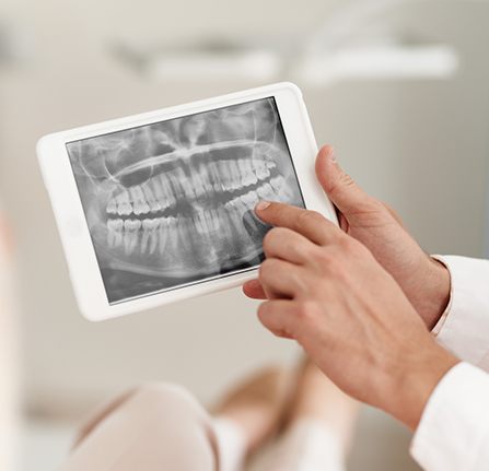 Panoramic dental x-rays on tablet computer