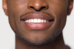 Closeup of beautiful smile thanks to cosmetic dentistry