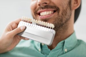 Dentist using shade guide to match color of crown